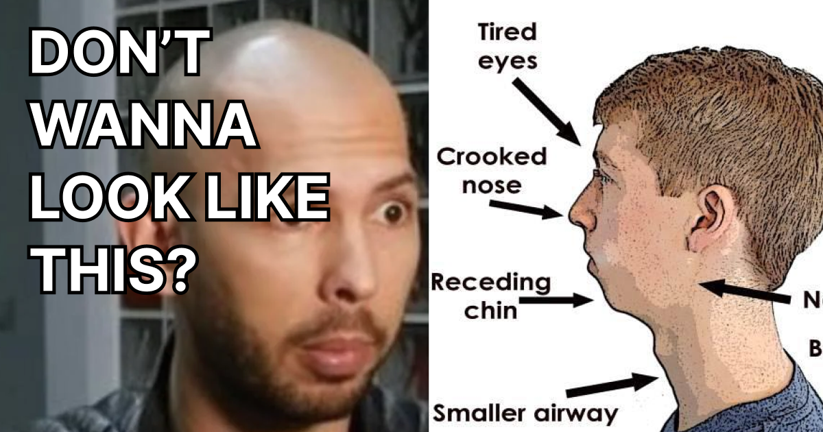 Mouthbreather